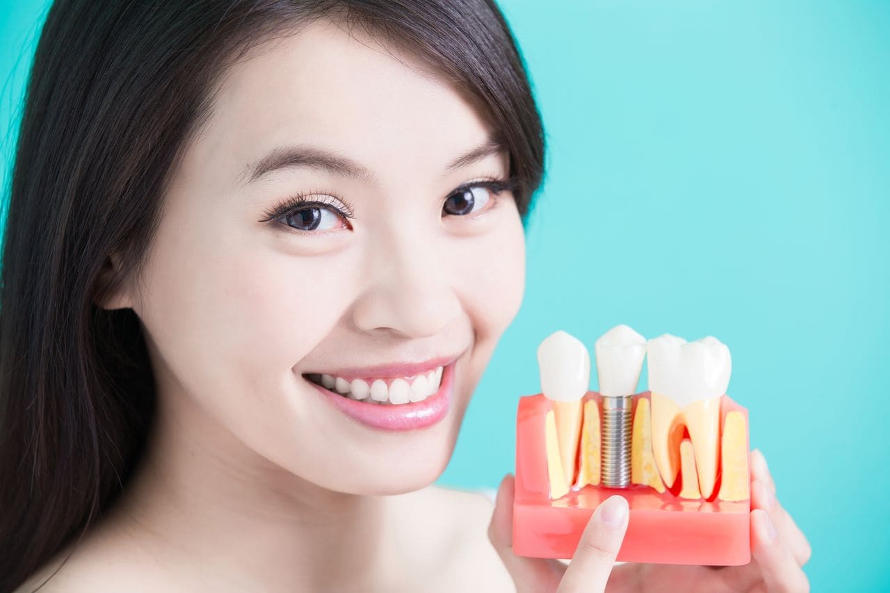 Преимущества полной имплантации зубов