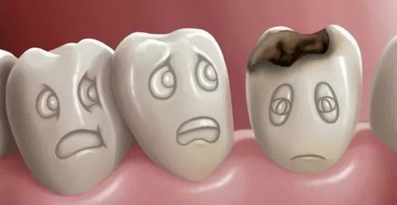 современные методы лечения кариеса зубов
