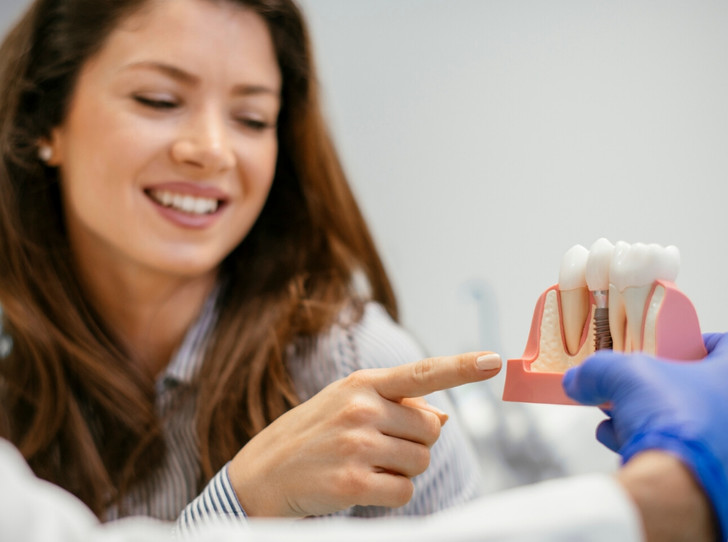 этапы установки зубных имплантов