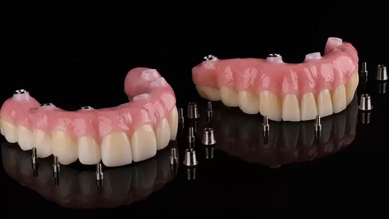 Зубной ряд с имитацией десны